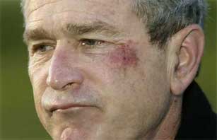 Bush After Near Fatal Accident w/ Pretzel