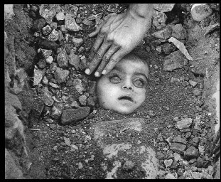 Bhopal Child Victim