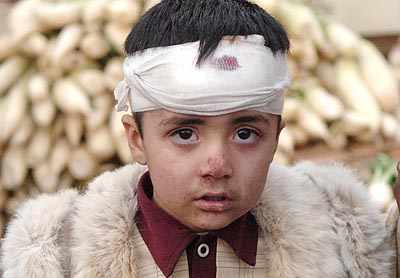 Earthquake survivor in Musafrabad